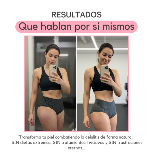 Veloria™ Aceite Anti-Celulitis